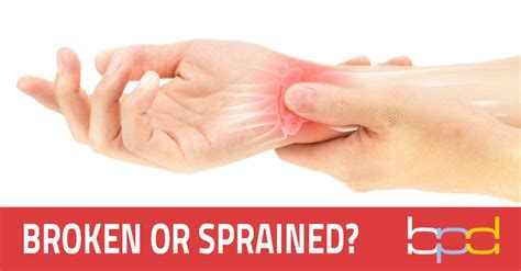 Broken or Sprained Wrist - Brandon P. Donnelly, MD