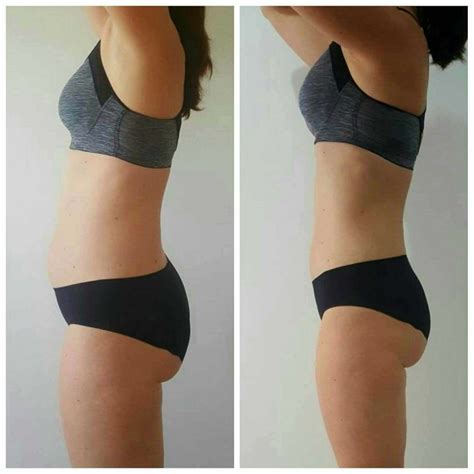 Before & after results and pictures of Electrical Muscle Stimulation ...