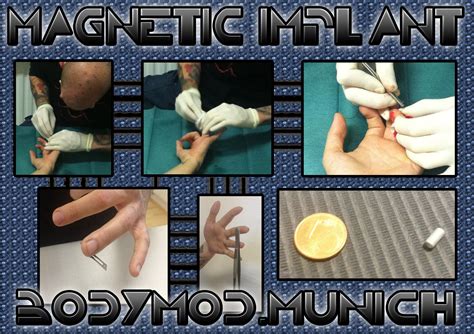 Magnetic Implant Done by Thomas @ Tempel München Magnet by @ Samppa von Cyborg | Bodymodification