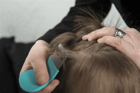 What Do You Need to Know About Getting Proper Head Lice Removal? ~ Expert Lice Removal Services