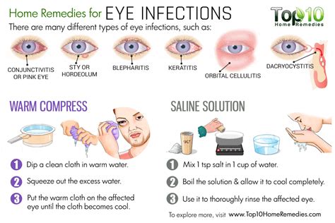 Home Remedies for Eye Infections | Top 10 Home Remedies | Stuffy nose remedy, Allergy remedies ...