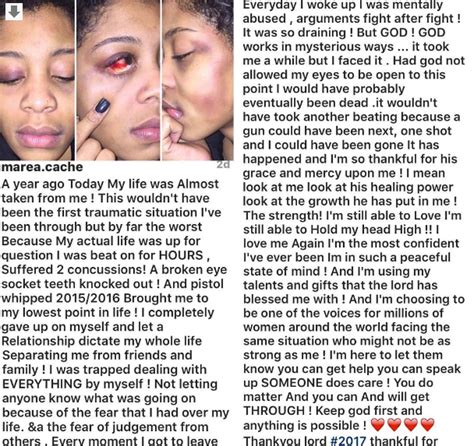 Domestic Violence Victim Tells Survivor Story One Year After | FalzNaija