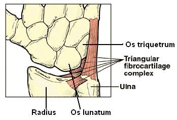 Ulnar Shortening—Avoid This Barbaric Procedure - Regenexx®