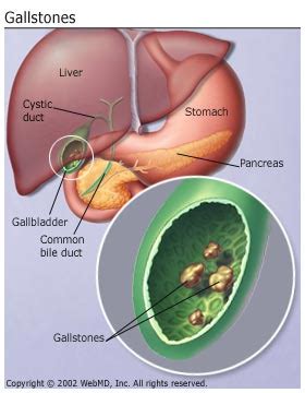 HCV New Drugs: Scientists develop new gallbladder endoscopy