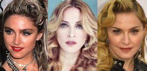 Madonna Plastic Surgery Before and After Pictures 2024