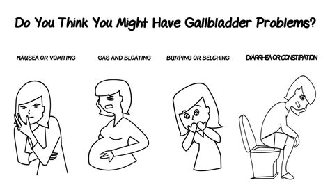Gallbladder Symptoms - YouTube
