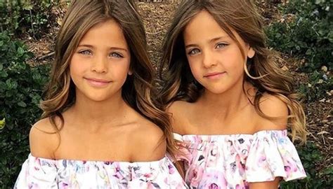 The Twins Named Most Beautiful In The World Are All Grown Up | Twin ...