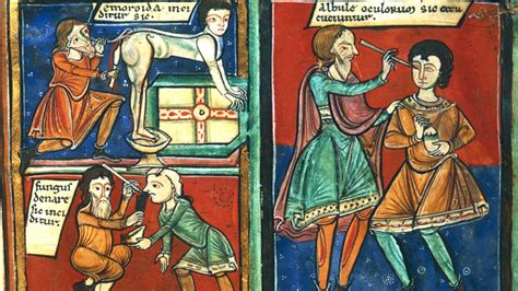 Històries Manresanes: La cirurgia medieval i els barbers