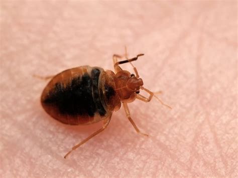 NYC Is Second-Most Bed Bug-Infested City, Ranking Says | New York City, NY Patch