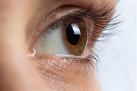 Eye Care Series: Symptoms of Keratoconus - Swagel Wootton Eye Institute