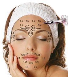 botox injection sites diagram - Google Search Laser Face Treatment, Facial Skin Treatment, Skin ...