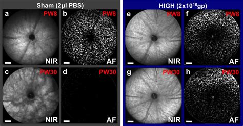 Gene therapy gives long-term protection to photoreceptor cells in a mouse model of retinitis ...