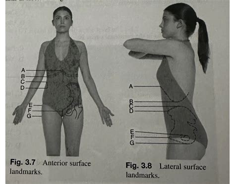 Anterior and lateral surface marks Quiz