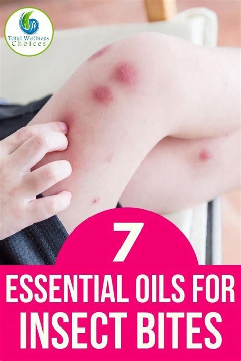 Here are the best essential oils for insect bites to help you relieve ...