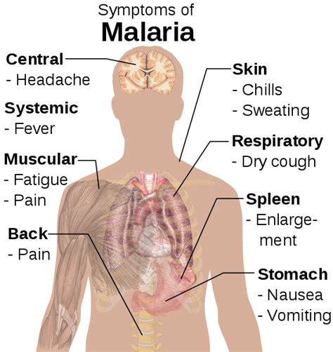 File:Symptoms of Malaria.svg - ဝီကီပီးဒီးယား