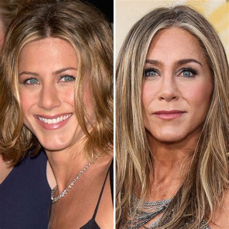 Jennifer Aniston Slammed for Plastic Surgery Amid 'The Morning Show' Premiere