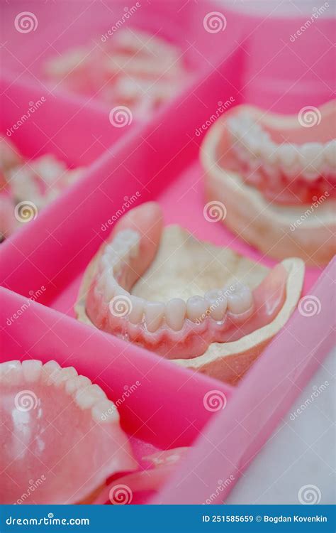 False Teeth in the Dental Office.Dentistry and Healthcare Concept at ...