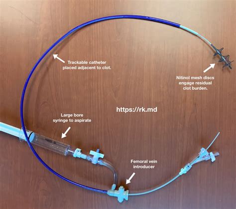 Inari FlowTriever | RK.MD