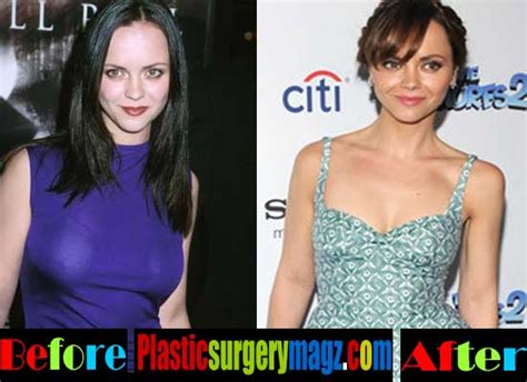 Christina Ricci Plastic Surgery Before and After | | Plastic Surgery Magazine