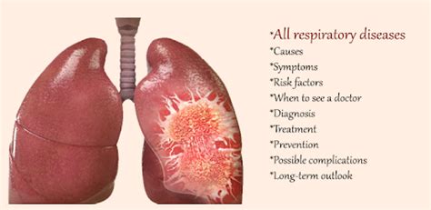 All Respiratory Disease and Treatment - Apps on Google Play