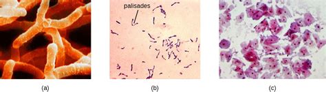 Gram-Positive Bacteria | Microbiology