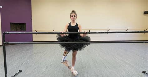 This 15-Year-Old Ballerina Who Lost One Of Her Legs To Cancer Still ...