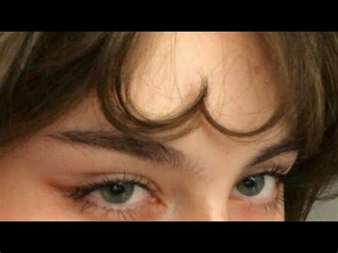 ღ your forehead is so flat! ~ forehead reshaping procedure 💉 - YouTube