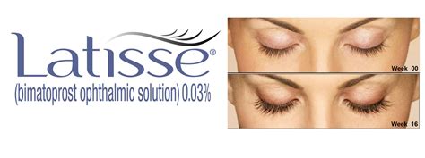 Latisse Eyelash Enhancement | Advanced Skin Therapy of Smokey Point