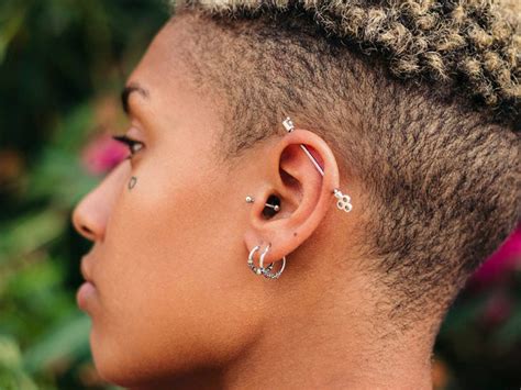 What Causes Keloid Scars On Piercings