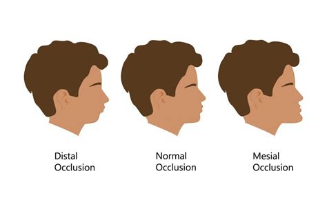 Orthotropics - Improving Facial Form and Guiding Growth | QOVES