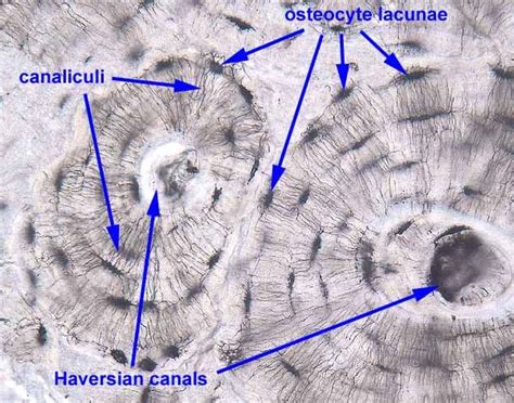 Hyaline Cartilage | Medical laboratory science, Histology slides ...