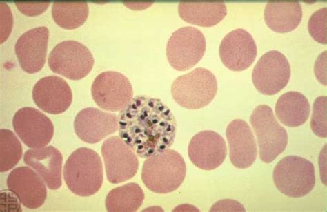 Plasmodium Vivax Microbewiki - Riset