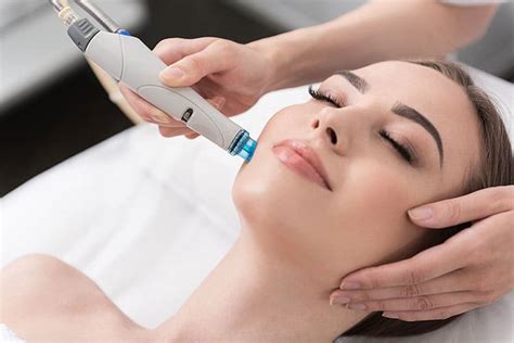 Dermabrasion | Skin Refinishing | Dr. Peter Kay