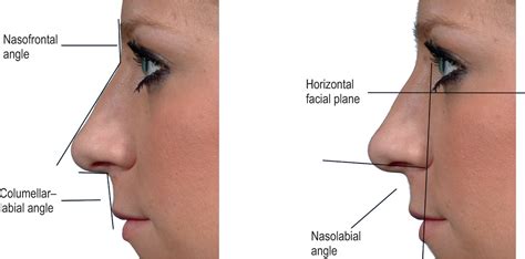 Nasal analysis and anatomy - Clinical Tree