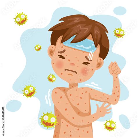 Rubella Rash fever. German measles. A sick boy with fever and red rash ...