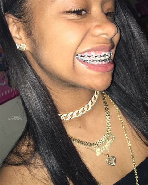 Pin on • BRACEFACE