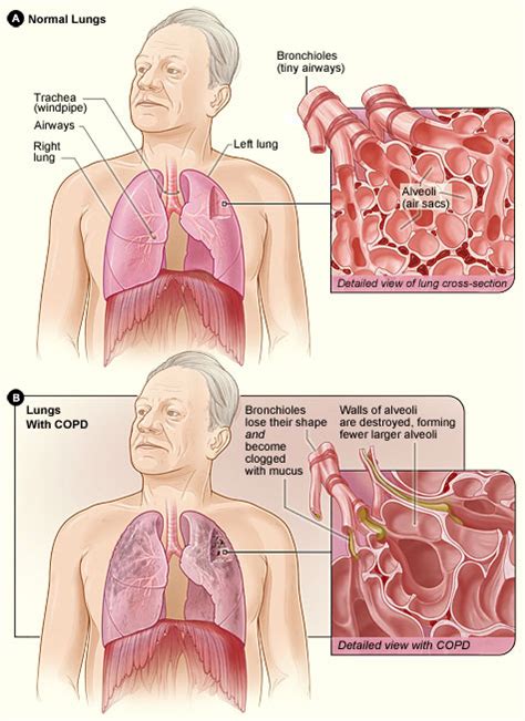 3. Anatomy and Physiology of Breathing | ATrain Education