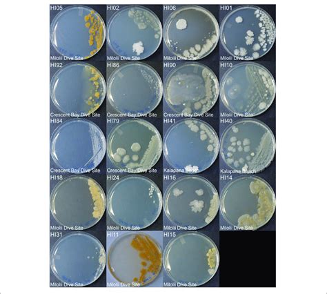 | Representative bacterial colonies with different morphologies growing... | Download Scientific ...