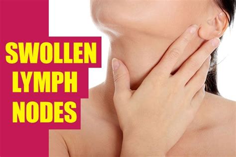Swollen lymph nodes treatment - nipodcams