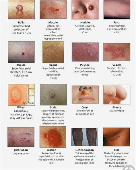 Dermatology Skin Terminology - Physician Assistant/Medical Student ...