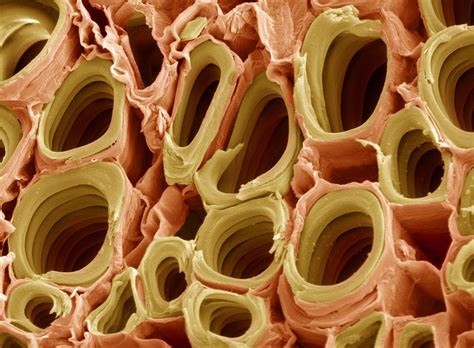 Xylem Cell Under Microscope