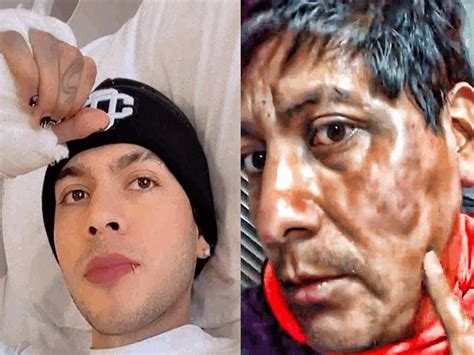 Juan de Dios Pantoja es hospitalizado tras golpear al 'acosador de Tiktok' HD wallpaper | Pxfuel