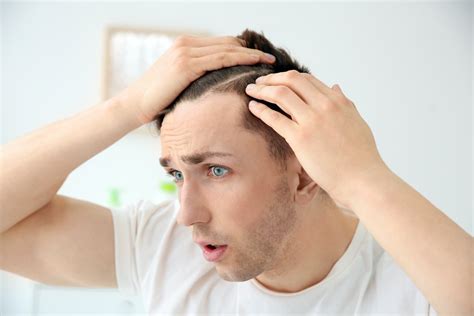 HAIR LOSS PREVENTION FOR MEN