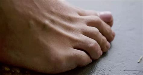 Hammer Toe Exercises - Symptoms, Causes, Treatment - Learning Physio