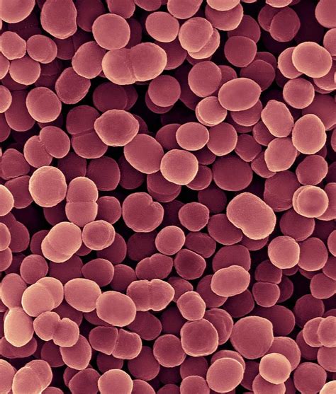 Moraxella Catarrhalis Gram Stain