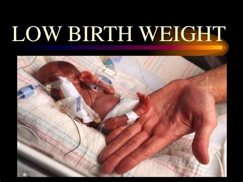 Low Birth Weight LBW - Presented By Mohammed Haroon Rashid