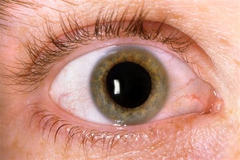 What Is Mydriasis And Why Does It Occur? - Bullfrag