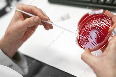 Medical microbiology - Stock Image - C021/6515 - Science Photo Library