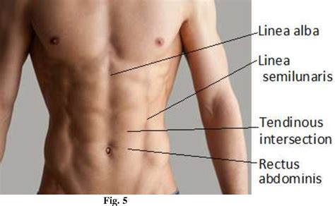 Figure 5 from Spigelian Hernias , A Diagnostic Enigma-A Case Report | Semantic Scholar