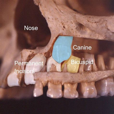 The Problem of Canines and Crowding During Early Development - Forbes ...